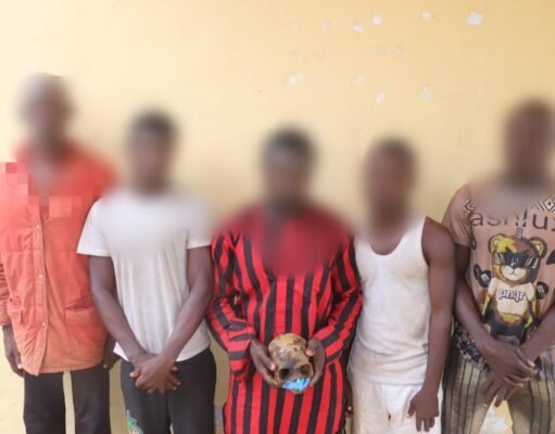 Man Arrested for Exhuming Grandmother’s Skull for Money Ritual