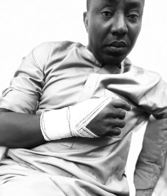 ‘They Broke My Wrist, Not My Spirit’, Sowore Released from Police Custody