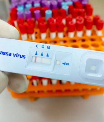 Lassa Fever: NCDC Confirms Three New Cases in Edo, Ondo